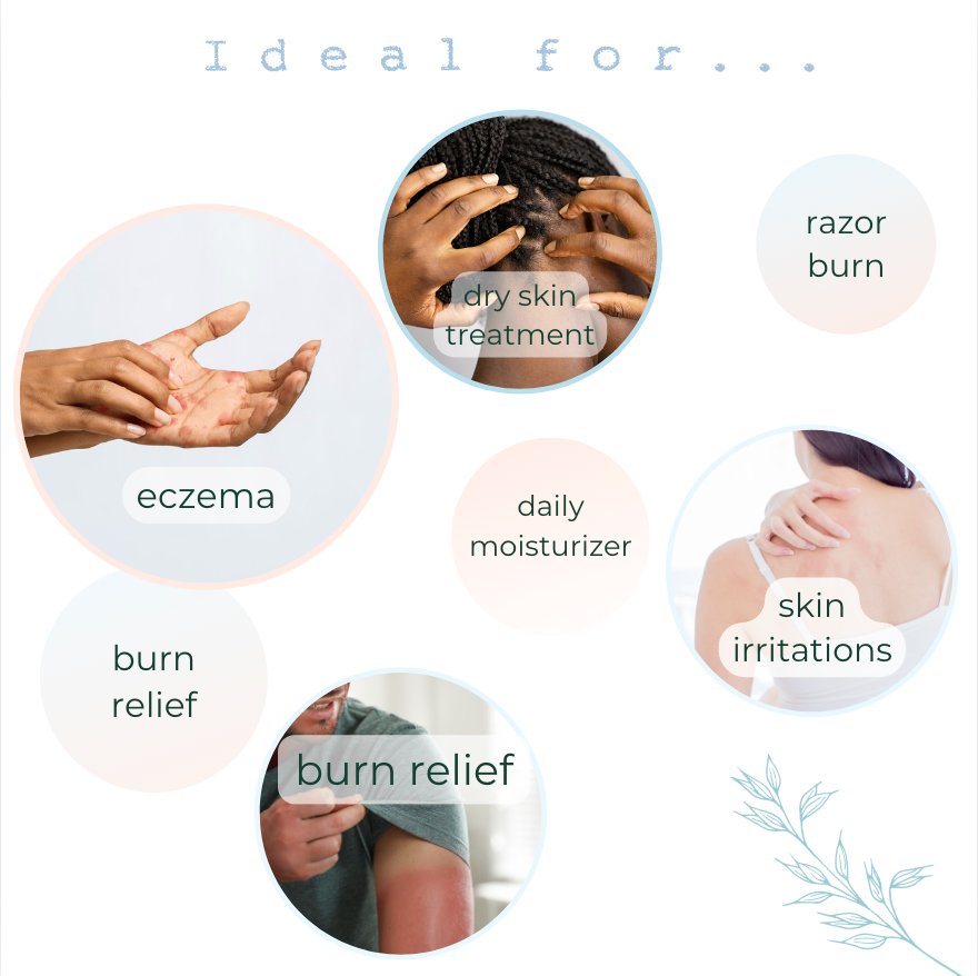 Skin Gel | Eczema - Nature's Aid, DEPRECATED,